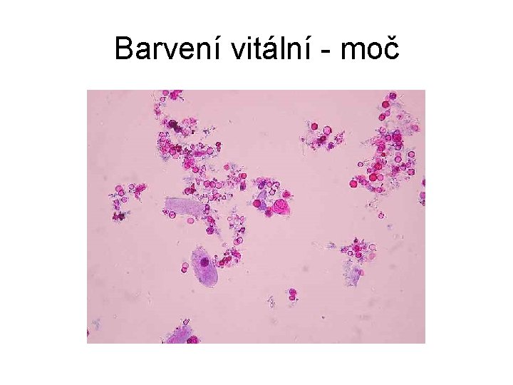 Barvení vitální - moč 