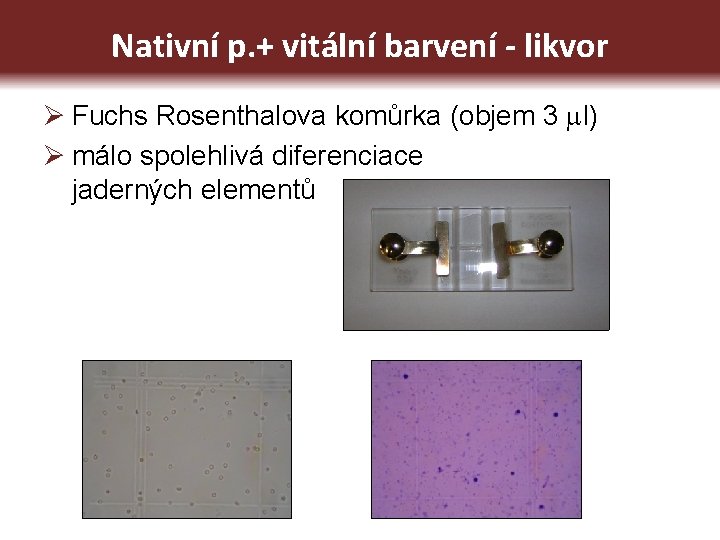 Nativní p. + vitální barvení - likvor Ø Fuchs Rosenthalova komůrka (objem 3 l)