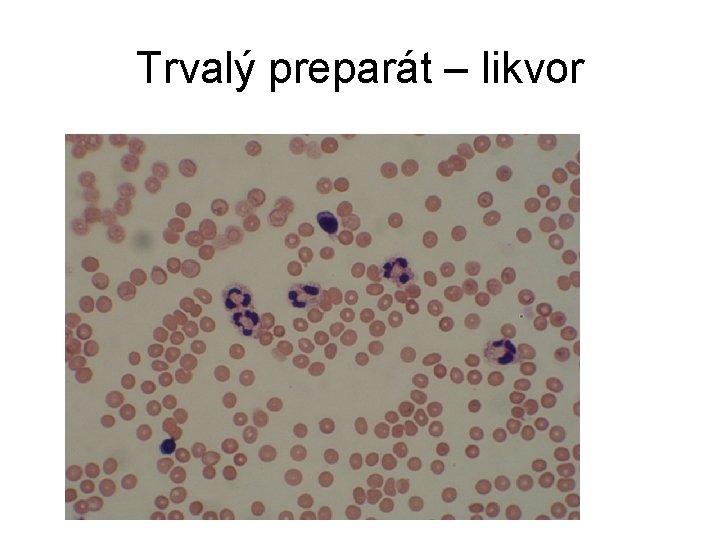 Trvalý preparát – likvor 