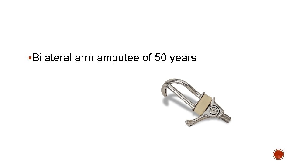 §Bilateral arm amputee of 50 years 
