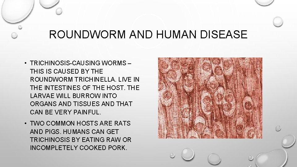 ROUNDWORM AND HUMAN DISEASE • TRICHINOSIS-CAUSING WORMS – THIS IS CAUSED BY THE ROUNDWORM