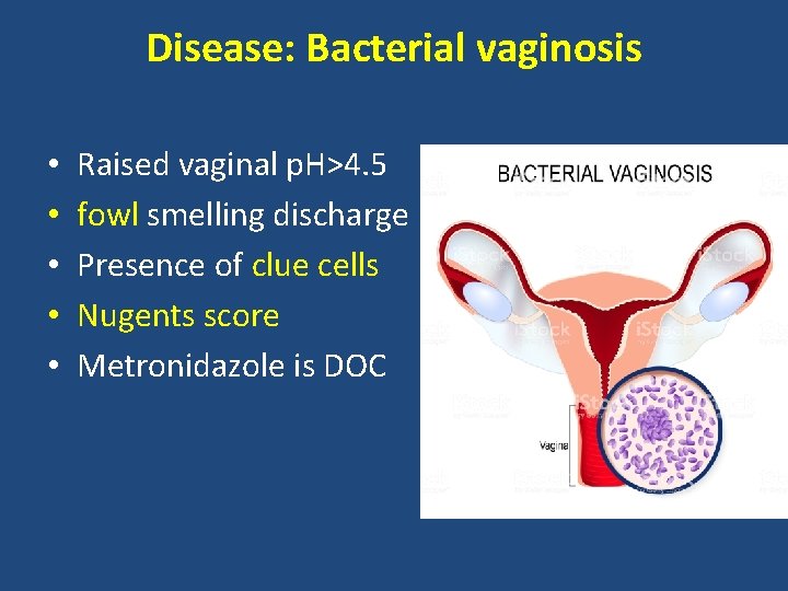 Disease: Bacterial vaginosis • • • Raised vaginal p. H>4. 5 fowl smelling discharge