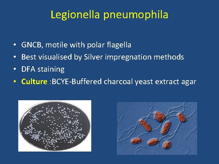 Legionella pneumophila • • GNCB, motile with polar flagella Best visualised by Silver impregnation