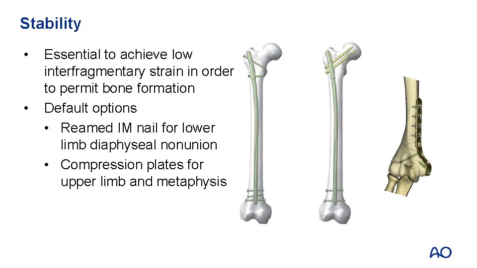 Stability • • Essential to achieve low interfragmentary strain in order to permit bone