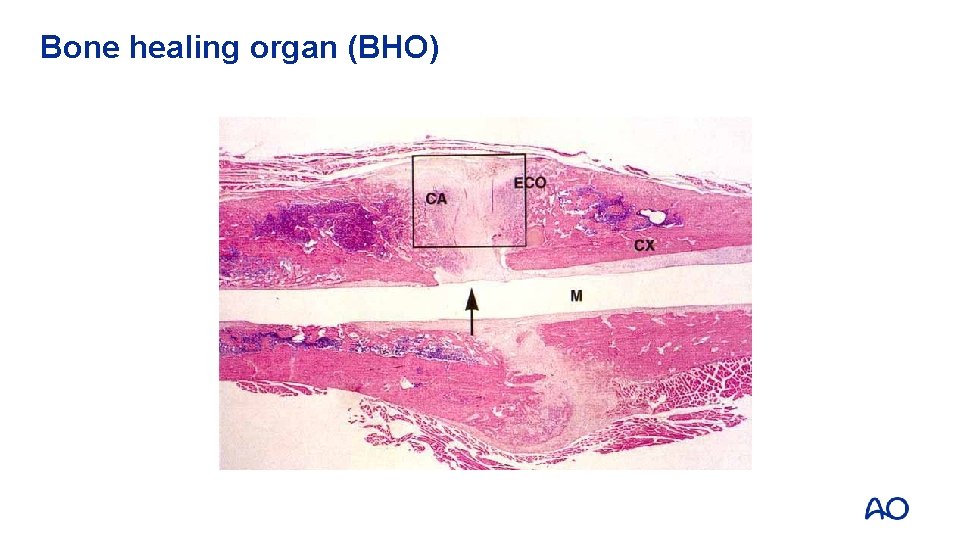 Bone healing organ (BHO) 