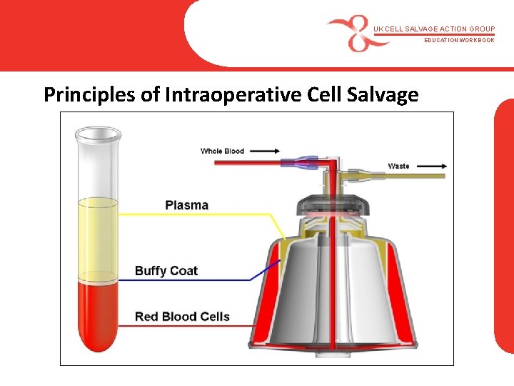 UK CELL SALVAGE ACTION GROUP EDUCATION WORKBOOK Principles of Intraoperative Cell Salvage 