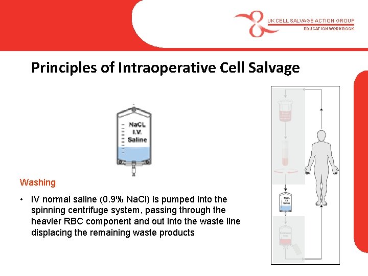 UK CELL SALVAGE ACTION GROUP EDUCATION WORKBOOK Principles of Intraoperative Cell Salvage Washing •