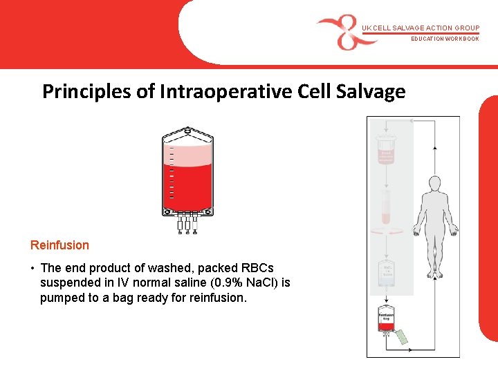 UK CELL SALVAGE ACTION GROUP EDUCATION WORKBOOK Principles of Intraoperative Cell Salvage Reinfusion •