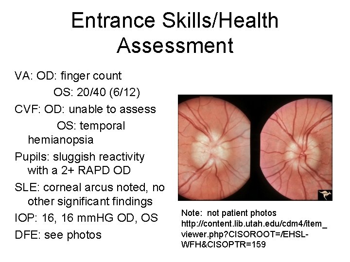 Entrance Skills/Health Assessment VA: OD: finger count OS: 20/40 (6/12) CVF: OD: unable to