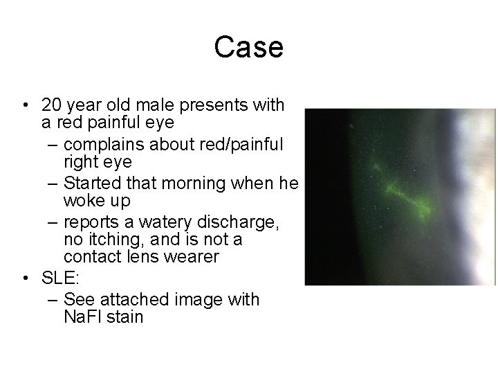 Case • 20 year old male presents with a red painful eye – complains