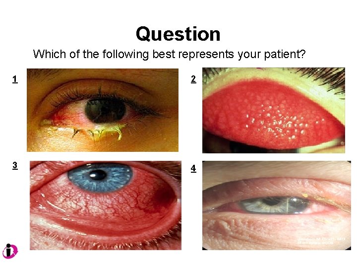 Question Which of the following best represents your patient? 1 2 3 4 