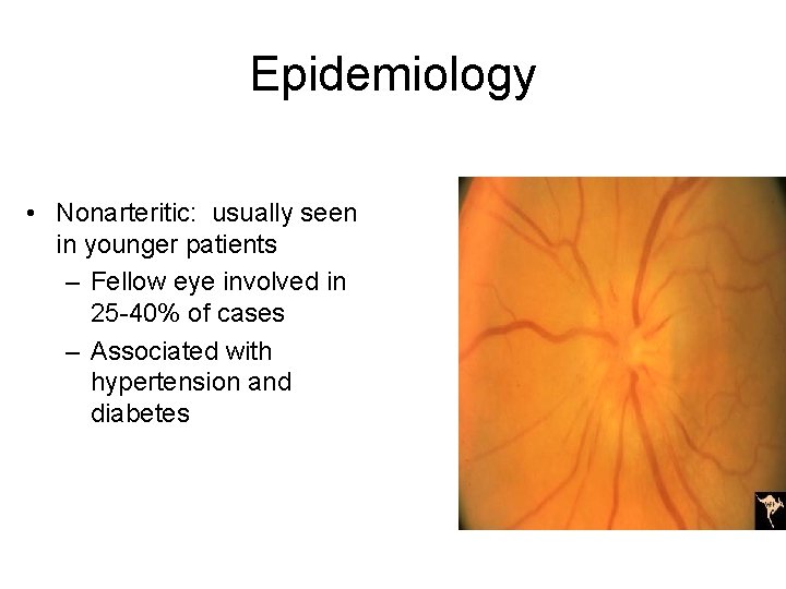 Epidemiology • Nonarteritic: usually seen in younger patients – Fellow eye involved in 25