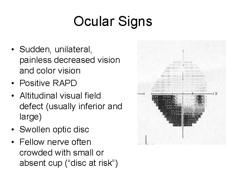 Ocular Signs • Sudden, unilateral, painless decreased vision and color vision • Positive RAPD