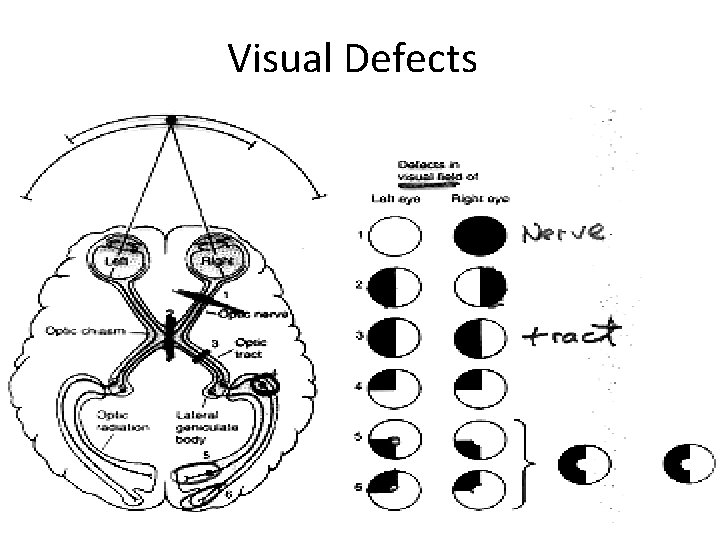 Visual Defects 