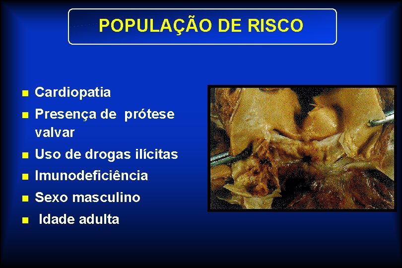 POPULAÇÃO DE RISCO n Cardiopatia n Presença de prótese valvar n Uso de drogas