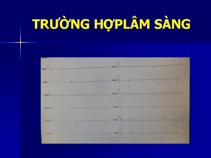 TRƯỜNG HỢPL M SÀNG 