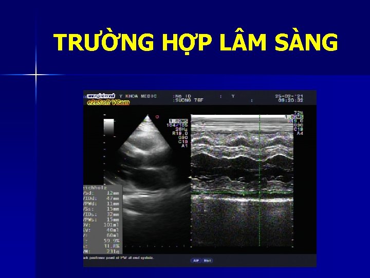 TRƯỜNG HỢP L M SÀNG 