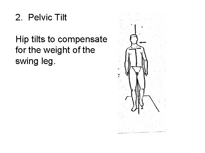 2. Pelvic Tilt Hip tilts to compensate for the weight of the swing leg.