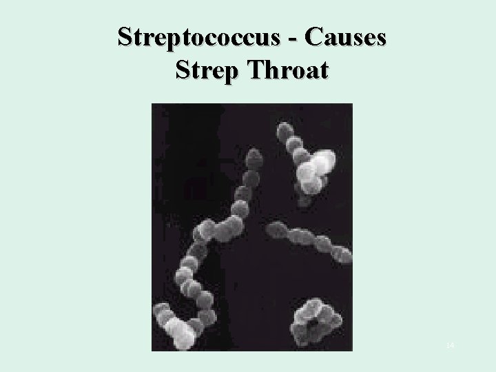 Streptococcus - Causes Strep Throat 14 
