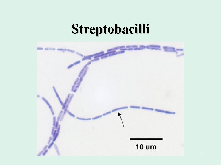 Streptobacilli 17 