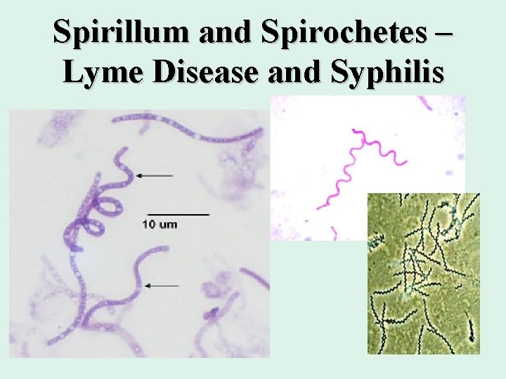 Spirillum and Spirochetes – Lyme Disease and Syphilis 18 