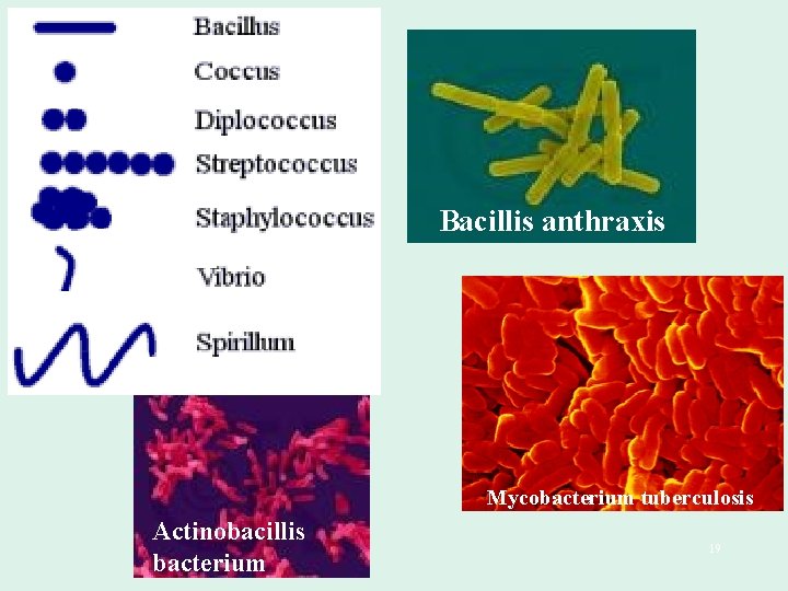 Bacillis anthraxis Mycobacterium tuberculosis Actinobacillis bacterium 19 