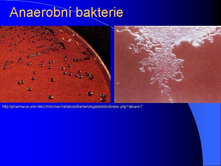 Anaerobní bakterie http: //pharmacie. univ-lille 2. fr/recherche/labos/Bacteriologie/photos/index. php? album=7 