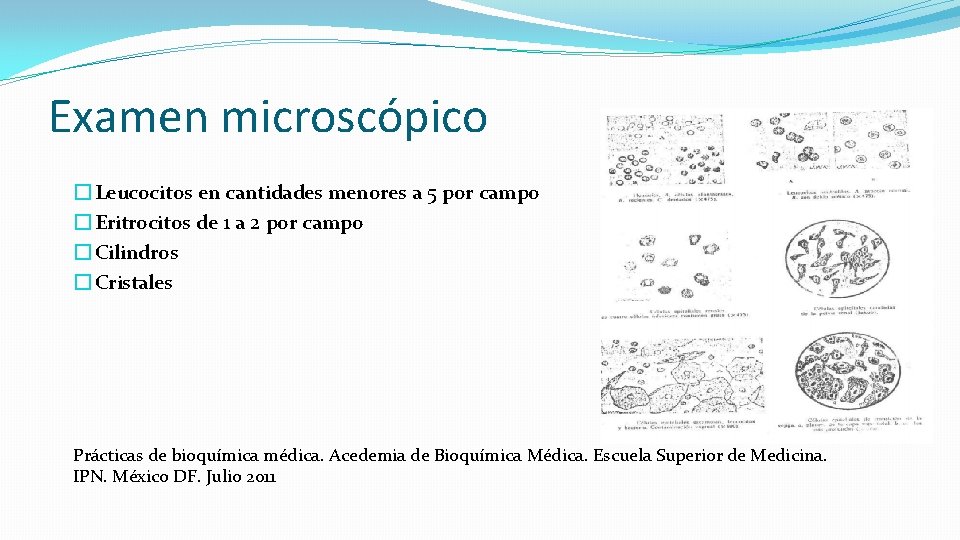 Examen microscópico � Leucocitos en cantidades menores a 5 por campo � Eritrocitos de