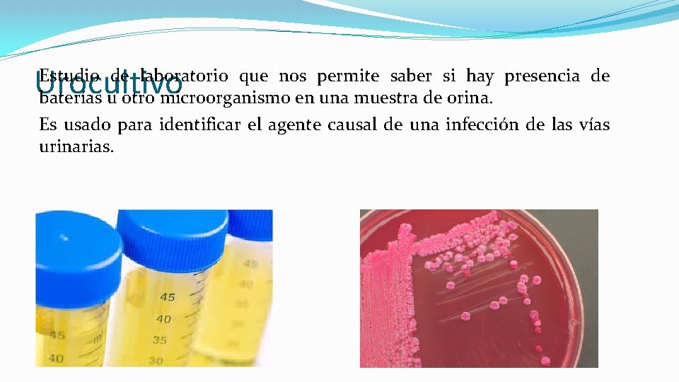 Urocultivo Estudio de laboratorio que nos permite saber si hay presencia de baterías u