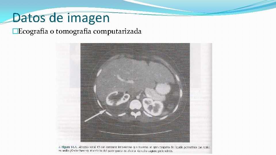 Datos de imagen �Ecografía o tomografía computarizada 