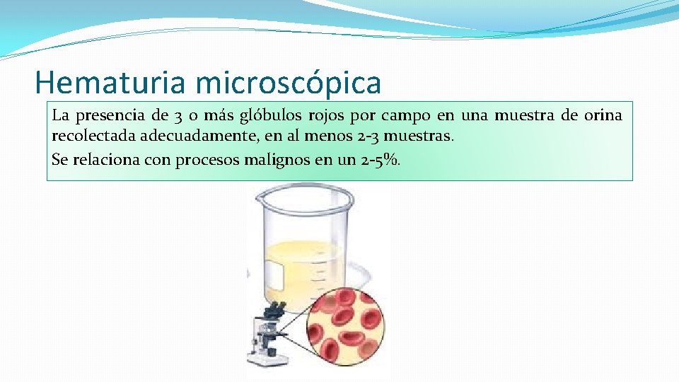 Hematuria microscópica La presencia de 3 o más glóbulos rojos por campo en una