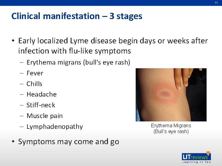 11 Clinical manifestation – 3 stages • Early localized Lyme disease begin days or