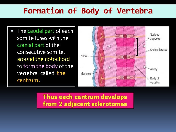 Formation of Body of Vertebra The caudal part of each somite fuses with the