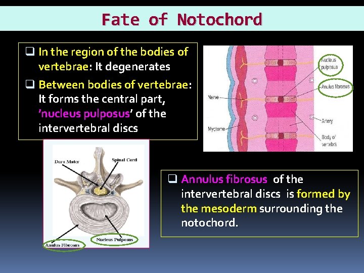 Fate of Notochord q In the region of the bodies of vertebrae: It degenerates