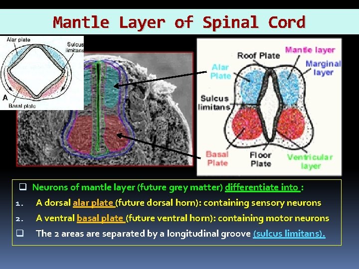 Mantle Layer of Spinal Cord q Neurons of mantle layer laye (future grey matter)