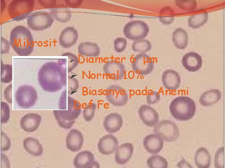 Mikrosit Ø Diameter 6 μm Ø Normal 10% Ø Biasanya pada Anemi Def Fe