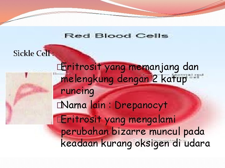 Sickle Cell : �Eritrosit yang memanjang dan melengkung dengan 2 katup runcing �Nama lain