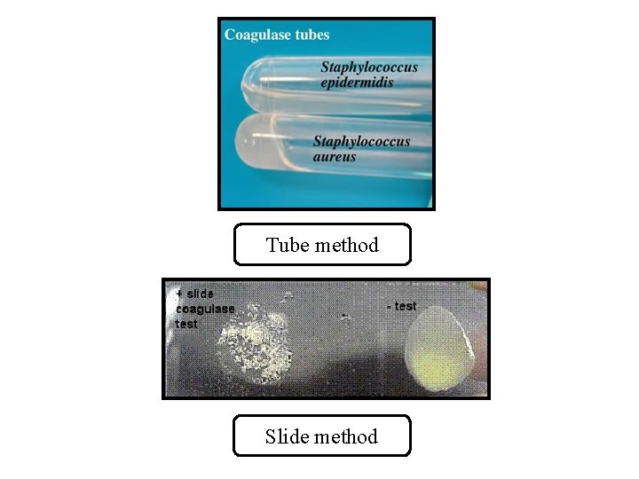 Tube method Slide method 