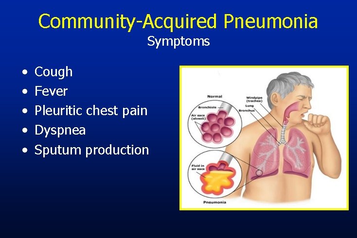 Community-Acquired Pneumonia Symptoms • • • Cough Fever Pleuritic chest pain Dyspnea Sputum production