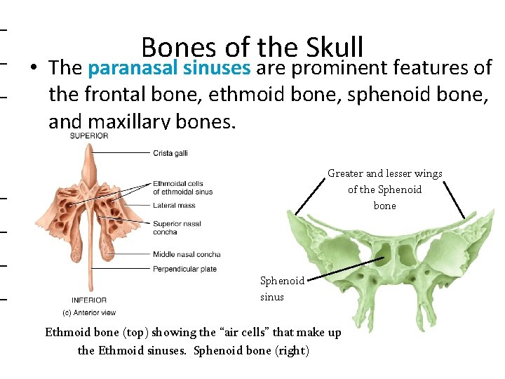 _ _ • _ _ _ Bones of the Skull The paranasal sinuses are