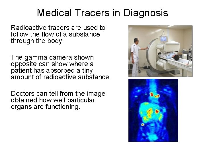 Medical Tracers in Diagnosis Radioactive tracers are used to follow the flow of a