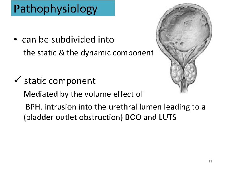 Pathophysiology • can be subdivided into the static & the dynamic component ü static