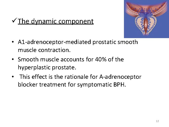 ü The dynamic component • A 1 -adrenoceptor-mediated prostatic smooth muscle contraction. • Smooth