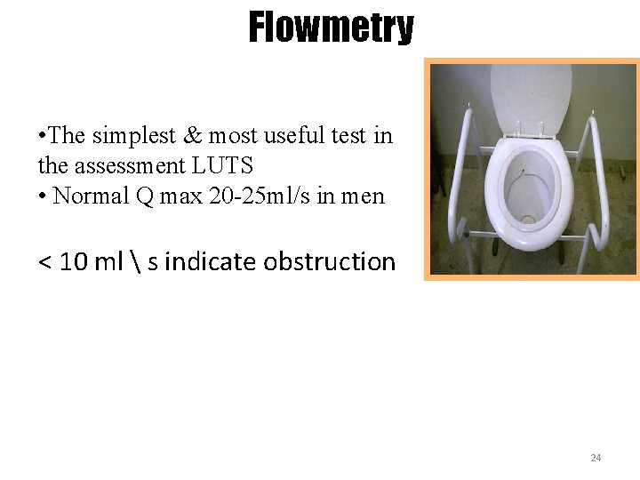 Flowmetry • The simplest & most useful test in the assessment LUTS • Normal