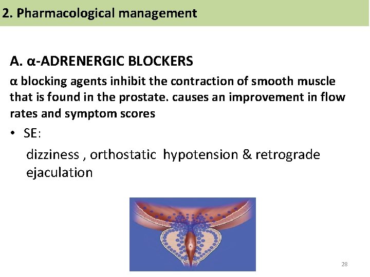 2. Pharmacological management A. α-ADRENERGIC BLOCKERS α blocking agents inhibit the contraction of smooth