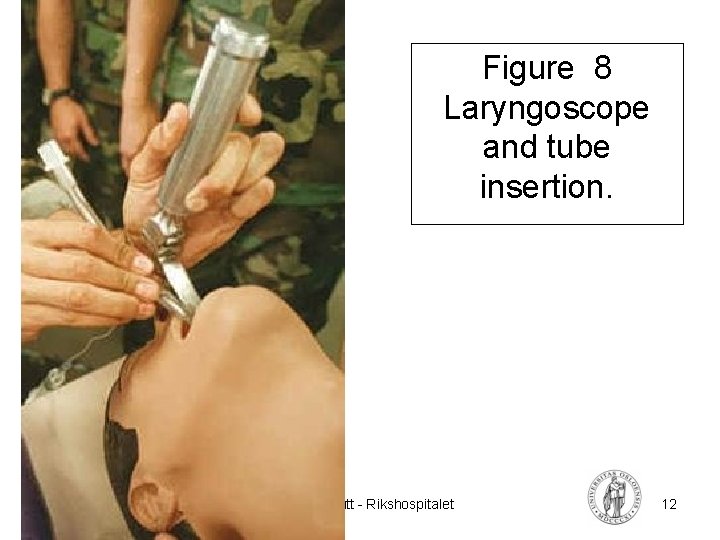 Figure 8 Laryngoscope and tube insertion. FYS 4250 Fysisk institutt - Rikshospitalet 12 