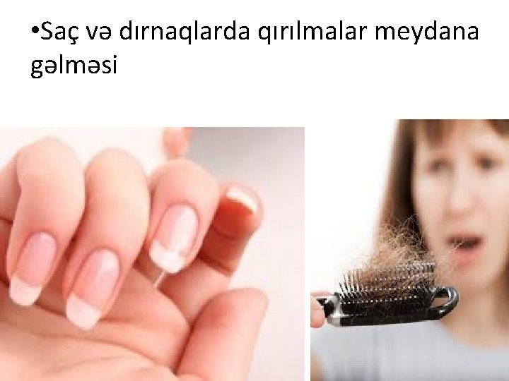  • Saç və dırnaqlarda qırılmalar meydana gəlməsi 