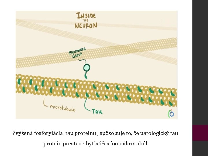 Zvýšená fosforylácia tau proteínu , spôsobuje to, že patologický tau proteín prestane byť súčasťou