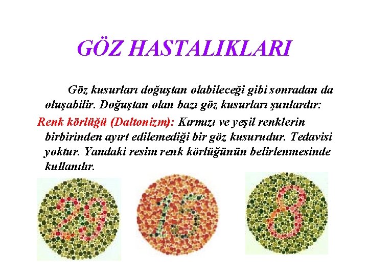 GÖZ HASTALIKLARI Göz kusurları doğuştan olabileceği gibi sonradan da oluşabilir. Doğuştan olan bazı göz