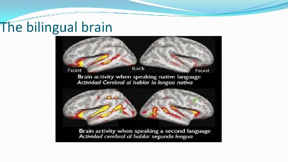 The bilingual brain 